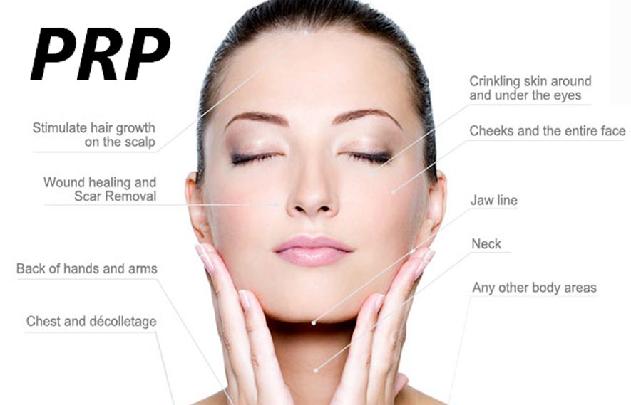 PRP For Facial