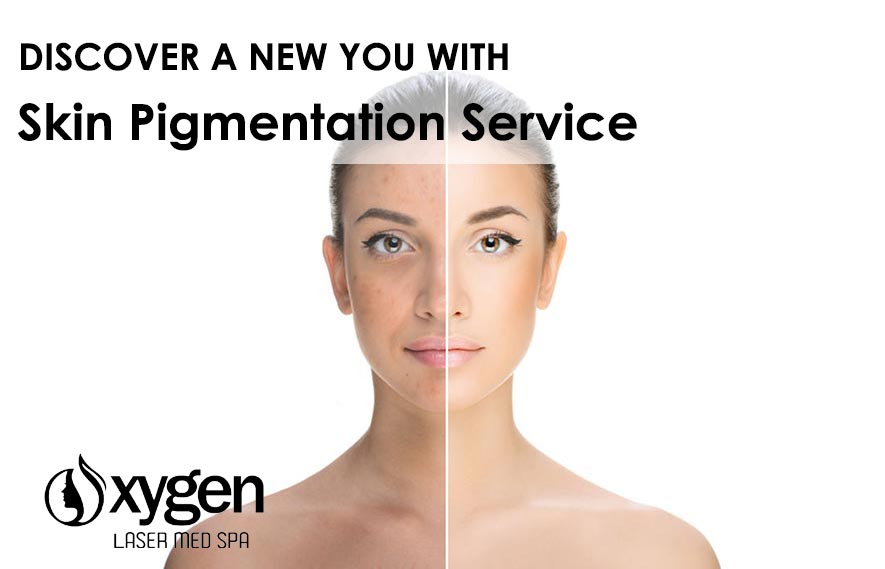 Skin Pigmentation