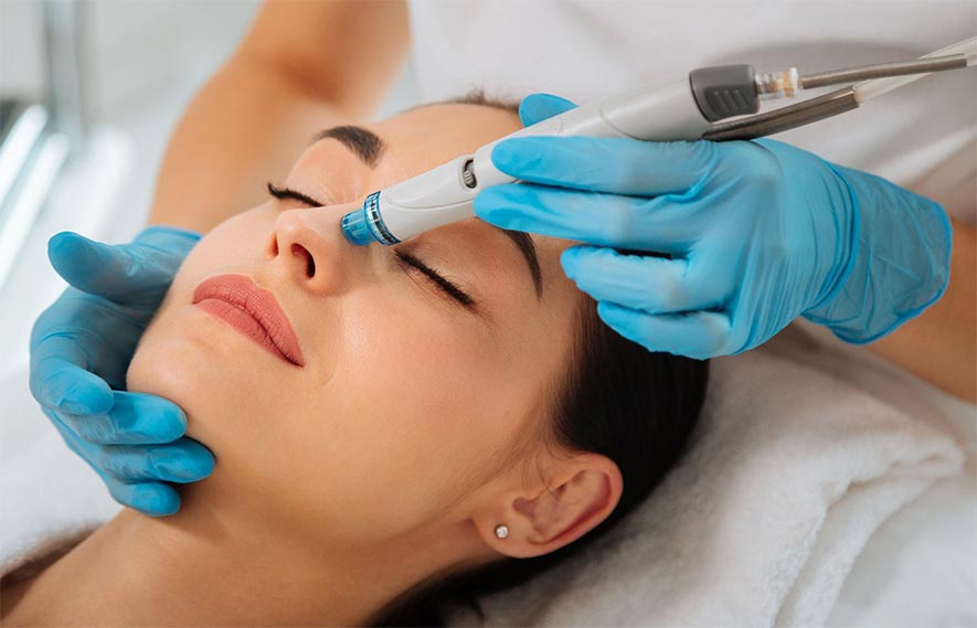 Hydrofacial Service in Orland Park