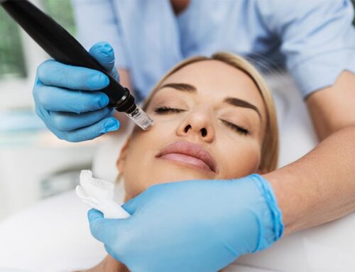 How to Increase Collagen Production for Firmer Skin Through Microneedling