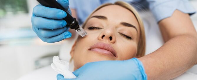 Microneedling Service in Orland Park
