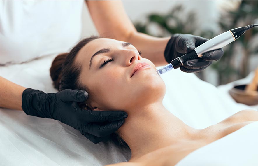 Microneedling Service in Orland Park